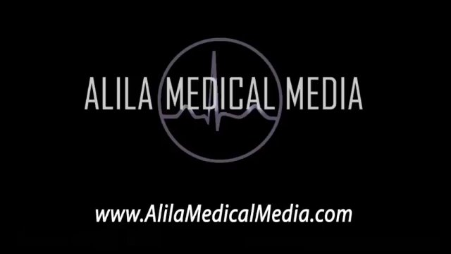 Thyroid Disorders: Hyperthyroidism vs Hypothyroidism With Lab Patterns & Management